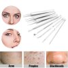 comedone extractor tweezers