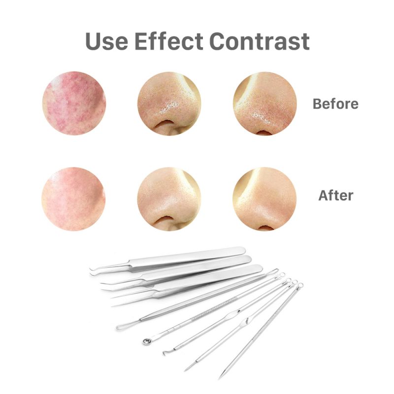 effect of acne needle tool